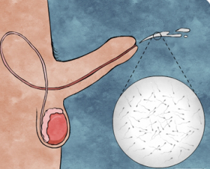 ejaculation retrograde