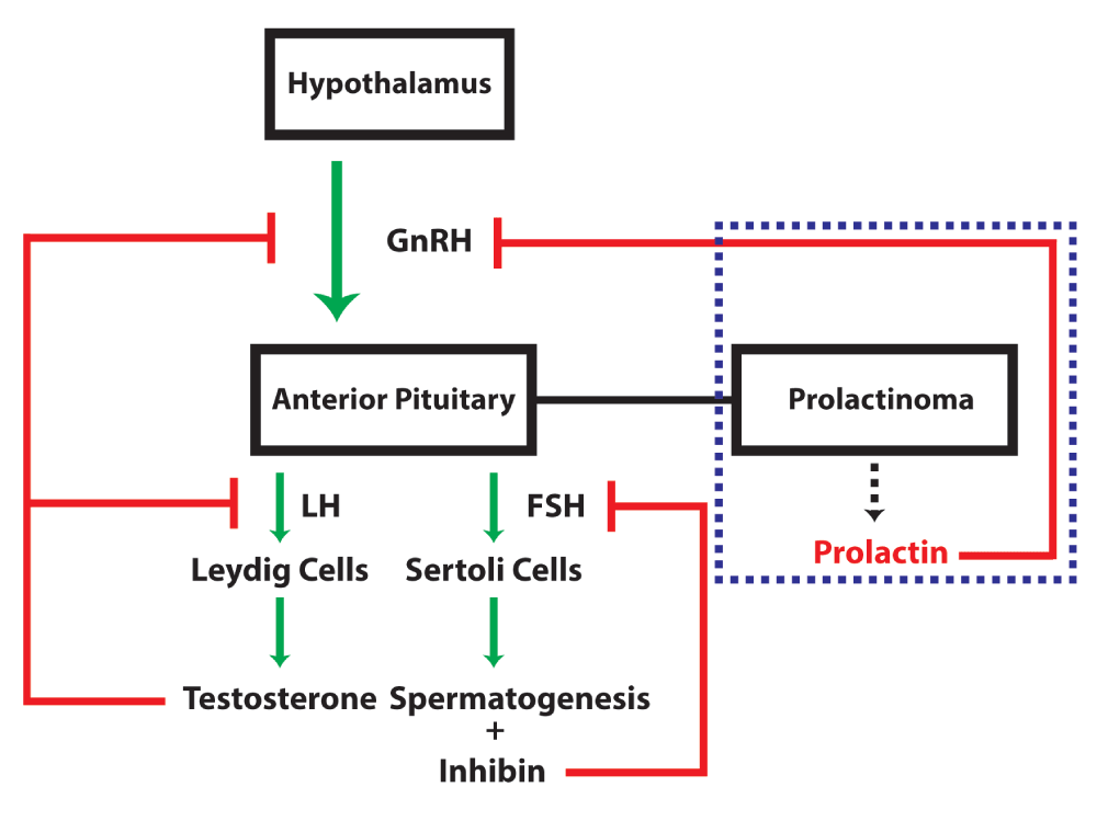 Erectile Dysfunction and High Prolactin Levels
